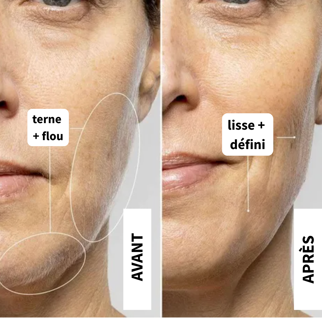 SkinPrep™