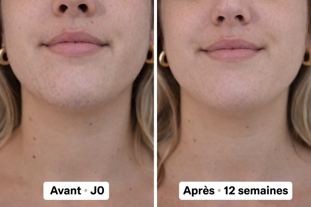 Avant / Après 12 semaines avec le Halo