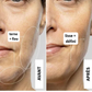 SkinPrep™